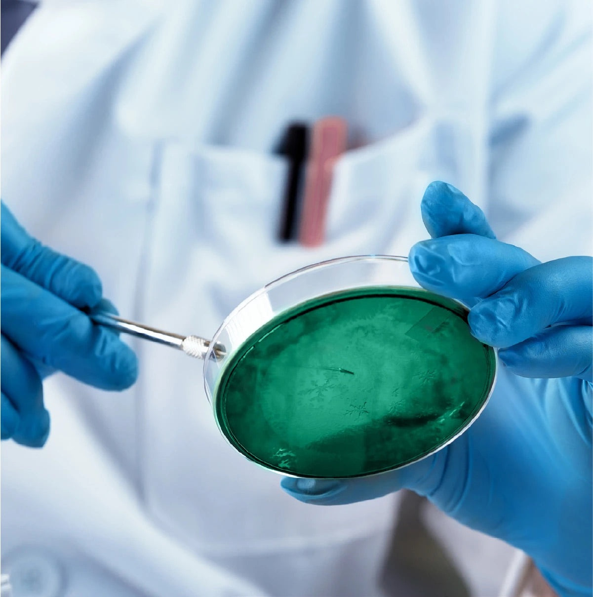 Čo sú to probiotiká ako fungujú