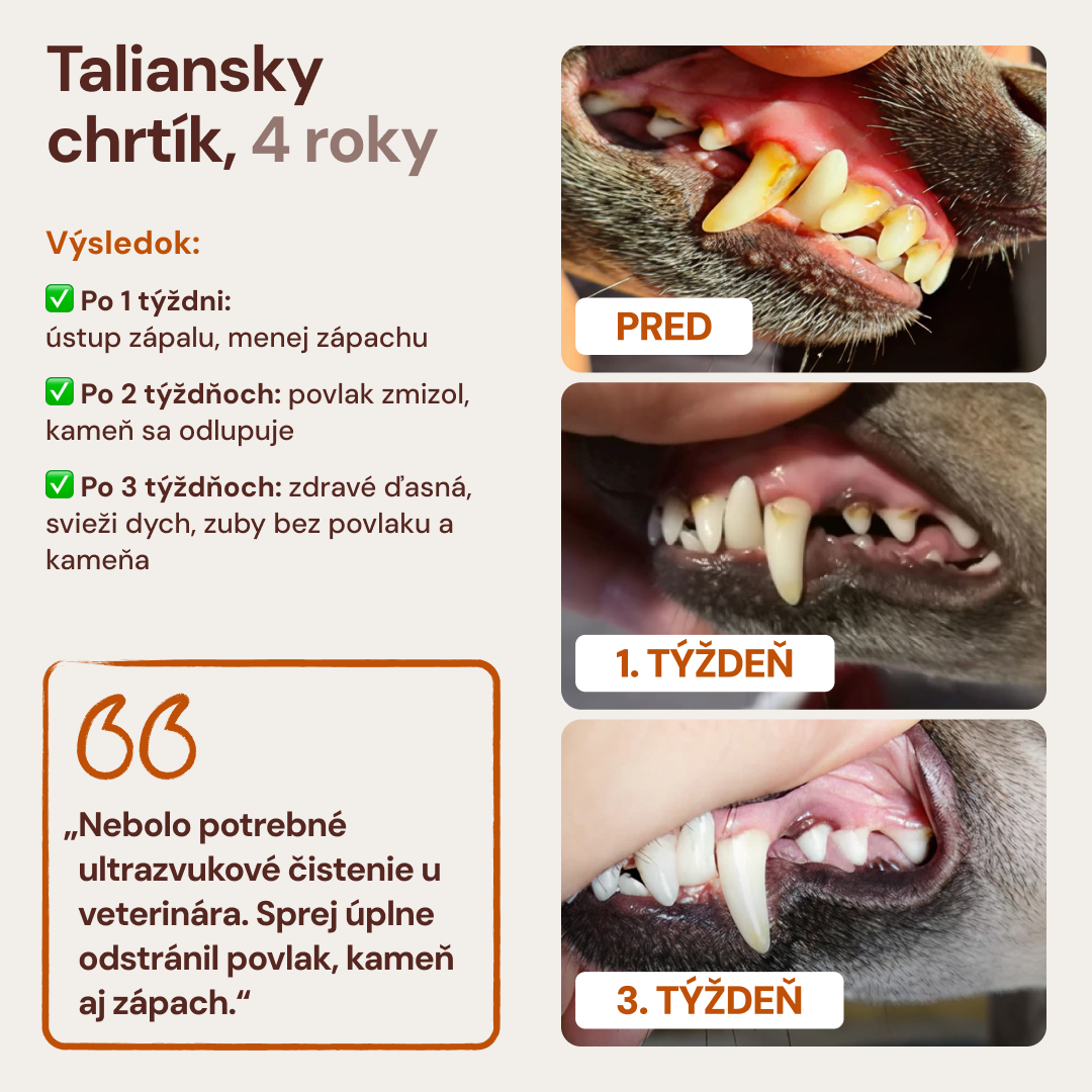 Lucaa+ Starostlivosť o zuby